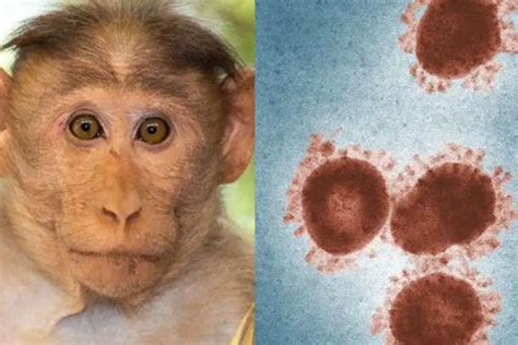 猴痘病毒症状图标信息图。头痛、背痛、淋巴结肿大、发热、皮疹等。欧洲和美国出现新疫情。插画图片素材_ID:425243984-Veer图库