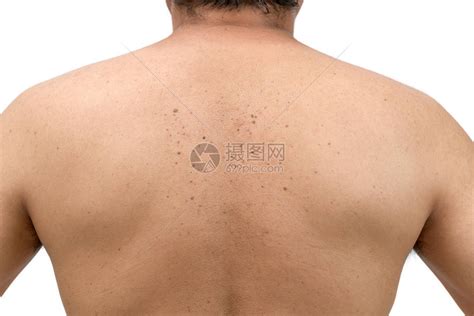 关闭皮肤或白背景被隔离的背部男子身上的血高清图片下载-正版图片504358236-摄图网