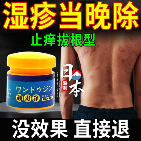 日本进口皮肤湿疹止痒去根外用顽固皮炎皮肤瘙痒肛周潮湿专用药膏-淘宝网