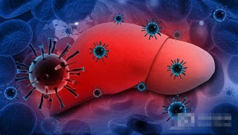 科学网—慢性HCV感染（5）直接作用抗病毒药物（DAAs）治疗的现状与问题 - 汪运山的博文
