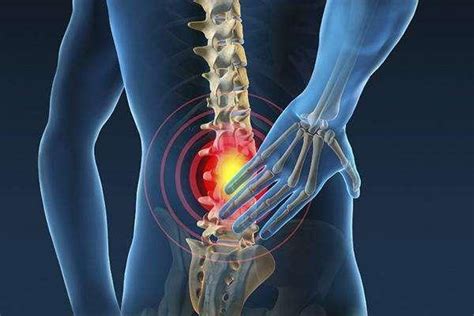 腰肌劳损急性期的治疗方法有几种_腰肌劳损_快速问医生