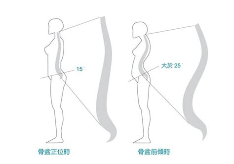 测量骨盆演示图图片