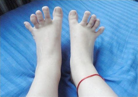 脚趾能否五指张开是基因差异吗？ - 知乎