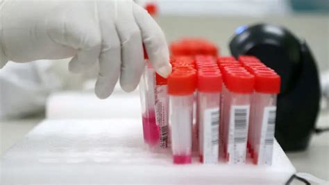 疫情防控丨无故不参加核酸检测，15人被立案调查！