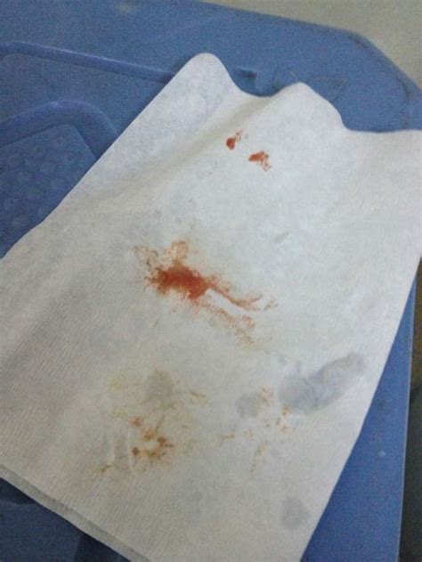 餐巾纸带血的图片图片