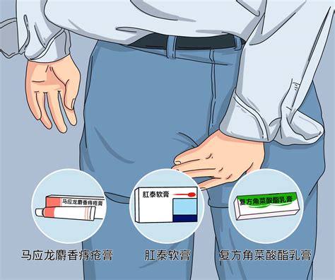 痔疮打针脱落图片