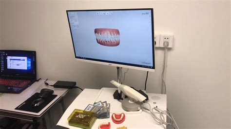 3shape设计牙齿-无喷粉口扫-口腔扫描仪_口内扫描仪_武汉易成三维科技有限公司