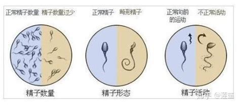 男性备孕，如何提高精子质量_凤凰网视频_凤凰网