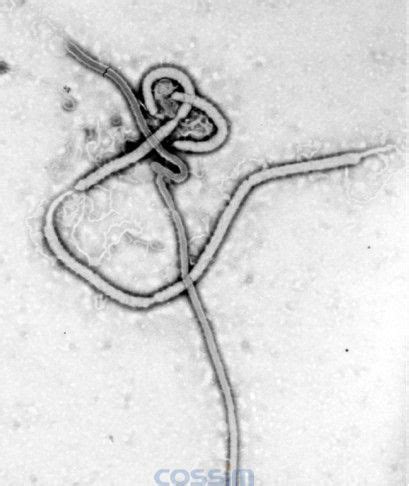 伊波拉病毒-震惊世界的黑死病（一）_北京世纪科信科学仪器有限公司