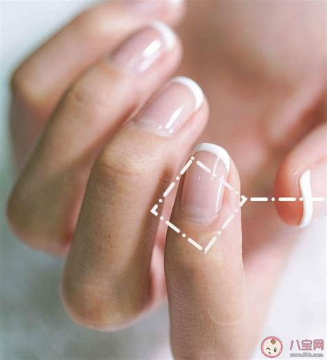 指甲上的月牙到底意味着什么? 一起来听听皮肤科医生给出的回答!|皮肤科医生|月牙|指甲_新浪新闻