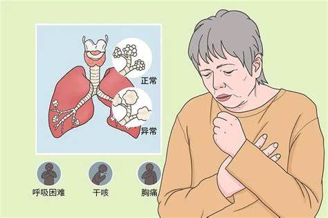间质性肺病及应对_再造人