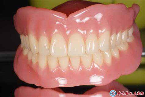 带你来了解什么是全口吸附性义齿？展示上海/北京装假牙价格 - 21怡口美牙网