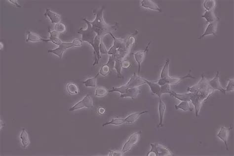 HEK-293T 人胚肾细胞-原代细胞-STR细胞-细胞培养基-赛百慷生物