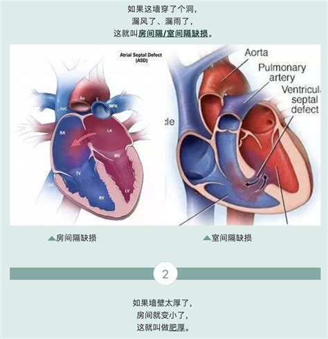 人类心脏,人体,手,拿着,模型,心脏病,冠状动脉,主动脉,心脏手术,心脏搭桥手术摄影素材,汇图网www.huitu.com