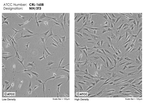 NIH/3T3细胞ATCC CRL-1658细胞 NIH3T3小鼠胚胎细胞株购买价格、培养基、培养条件、细胞图片、特征等基本信息_生物风