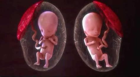 揭秘双胞胎是如何形成的？为什么有些长得很像有些连性别都不同？