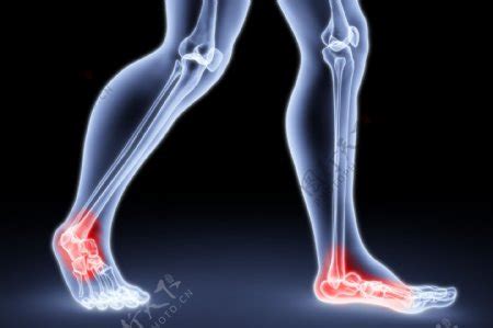 踝关节疼痛图片_科学技术_高清素材-图行天下素材网