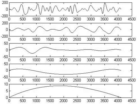 科学网—我们一篇脑电信号的压缩感知文章被IEEE T-BME接收了 - 张智林的博文