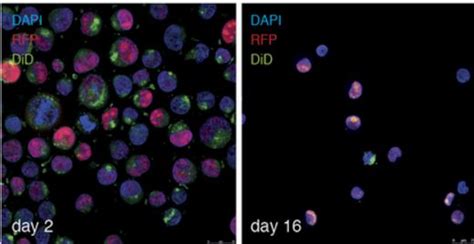 Nature：靶向转移的启动细胞通过脂肪酸受体CD36 - 江莱生物官网