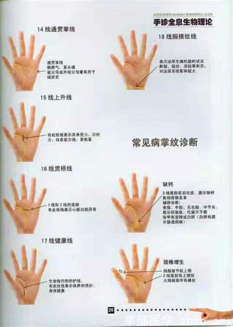 手诊图解看疾病图片