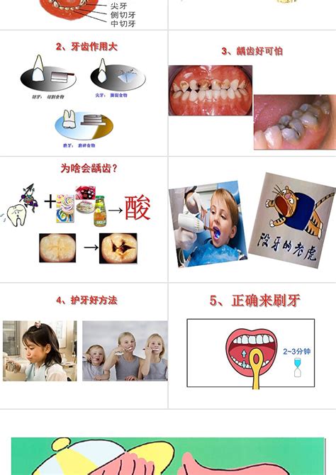 幼儿园公开课《保护牙齿》PPT模板下载_编号qxdnxjpd_熊猫办公