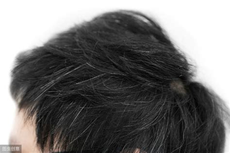 拔一根白头发真的会长十根吗，不及时治疗就会(长白发的4大原因) — 久久经验网