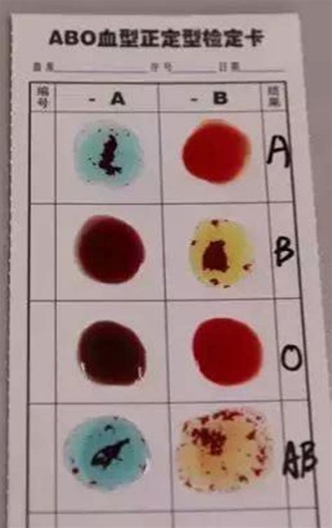 高中生物 | 直系血亲之间真的不能输血吗？！