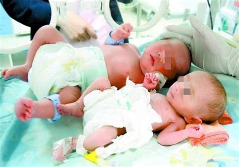 双胞胎宝宝如何喂养_双胞胎如何混合喂养 - 育儿指南