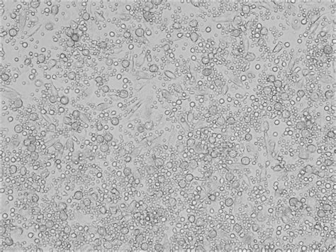 细胞の计数系列【1】全血中PBMC细胞的提取分离与检测-深圳市亨睿生物科技有限公司