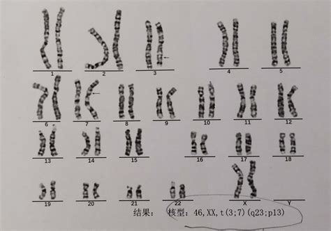 (1)从甲图中可以看出.正常人的体细胞中染色体是 存在的.每个细胞内共有 条染色体.(2)请用图解或表解等方式.表示染色体.DNA.基因之间的 ...