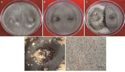 图3-6-27 真菌孢子-临床医学-医学