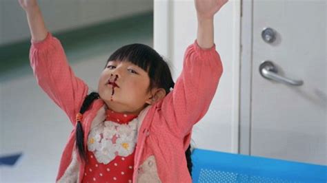 剧情：7岁女孩被扇了一巴掌，从此经常流鼻血，大夫一看直接让去大医院_腾讯视频