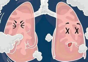 什么是肺结节？它和肺癌是“亲戚”吗？|肺结节|肺结核|症状|病因|-健康界