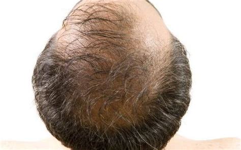 秃头,非全秃,成年的摄影素材,汇图网www.huitu.com