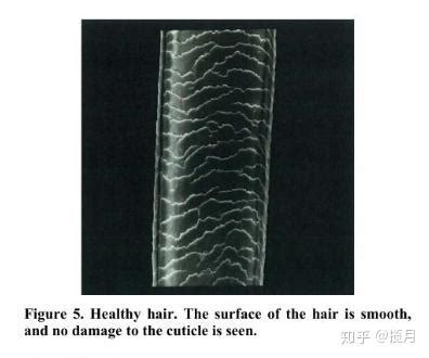头发有救了！科学家发现刺激头发生长的分子！_问题_毛囊_细胞