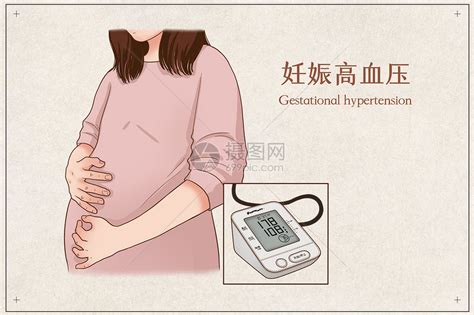 妊娠高血压医疗插画插画图片下载-正版图片401862620-摄图网