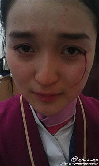 航班延误 南航女地服称被教师打伤致眼角流血 - 中国民用航空网