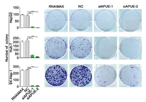 Midkine对神经母细胞瘤TNB1细胞生长与分化的影响