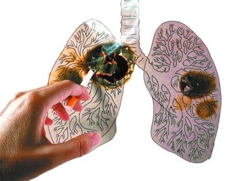 小细胞肺癌会不会传染？临床证实 小细胞肺癌不传染-小细胞肺癌概况-复禾健康