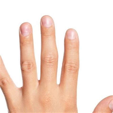 手指挫伤关节肿大怎么办_39健康经验