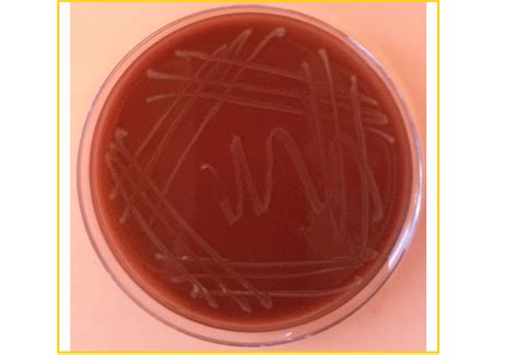 一种血清7型副猪嗜血杆菌天然弱毒菌株及其应用的制作方法
