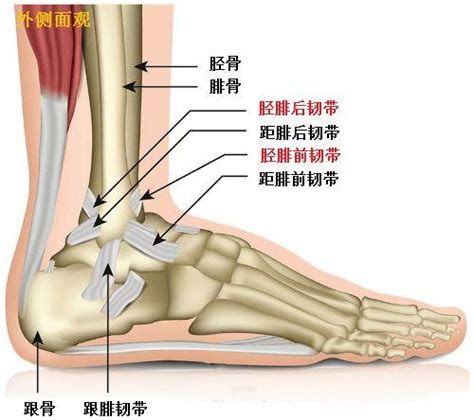 脚踝扭伤图片