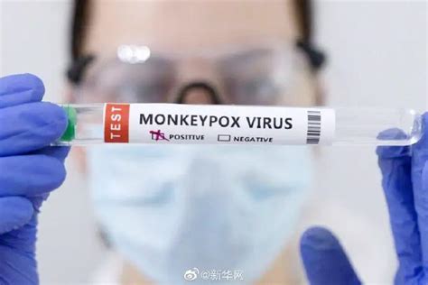 警惕！亚洲出现猴痘病例