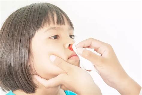 幼儿流鼻血的正确处理方法-幼儿园