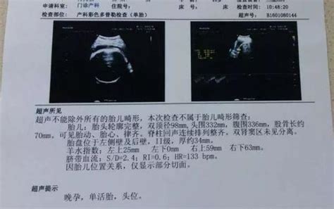 奥特曼b超单图片