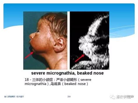 中国畸形婴儿处理办法（我国每年新生畸形儿近百万）-幼儿百科-魔术铺