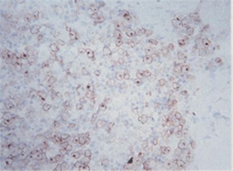 巨噬细胞对小鼠诱导多能干细胞向肝祖细胞分化的影响