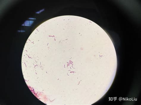 显微镜下的细菌病毒_图品汇