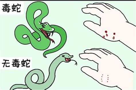 毒蛇咬伤的综合治疗护理ppt模板_卡卡办公