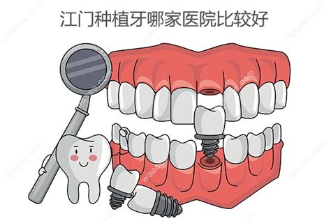 江门种植牙多少钱一颗,松鼠口腔种牙3999+同步口腔种牙771+ - 口腔资讯 - 牙齿矫正网